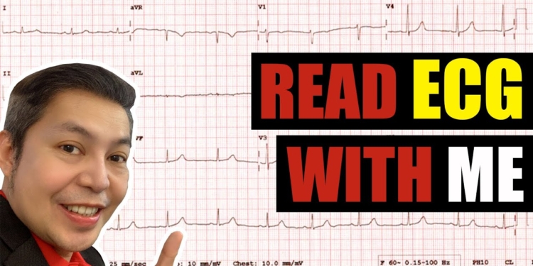 Read ECG with Me Under 5 Minutes! ECG #1