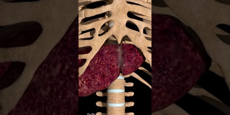 Can You Survive with Liver Cirrhosis