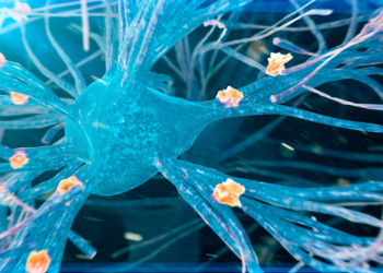 Alzheimer's Disease Advances Differently in Women