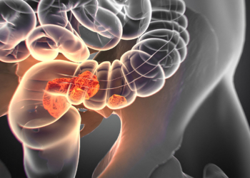 America Needs to Talk About Poop