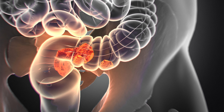 America Needs to Talk About Poop