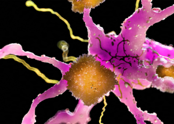 An Alzheimer's Revolution Is Coming, Experts Say