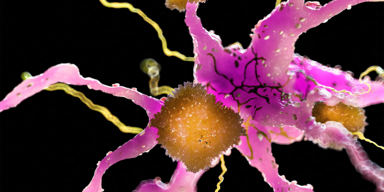 An Alzheimer's Revolution Is Coming, Experts Say