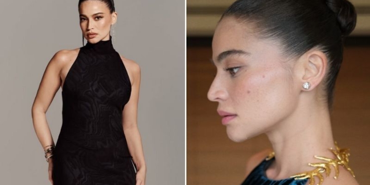 Anne Curtis slams Suntay