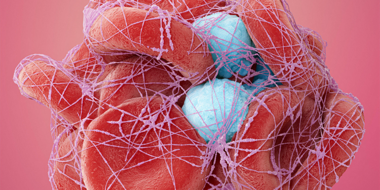 Apixaban Snags a Win in Head-to-Head Trial of Direct Oral Anticoagulants