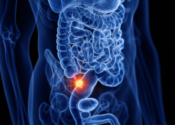 Are We Missing Tumors When Using Antibiotics Alone for Appendicitis?