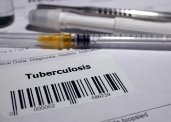 Are we in a paradigm shift in our #endTB response?