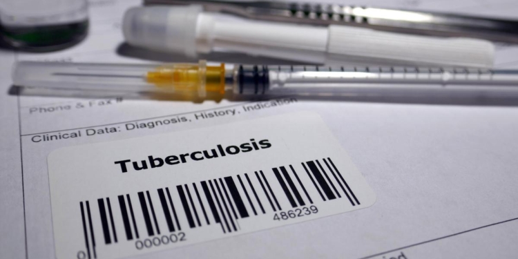 Are we in a paradigm shift in our #endTB response?