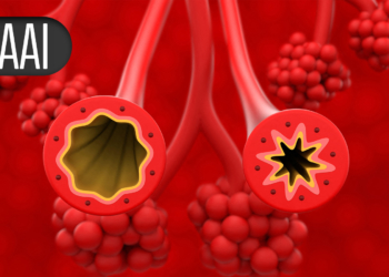 Biologic on Par With OIT for Turning Allergy-Forbidden Foods Into Everyday Eats