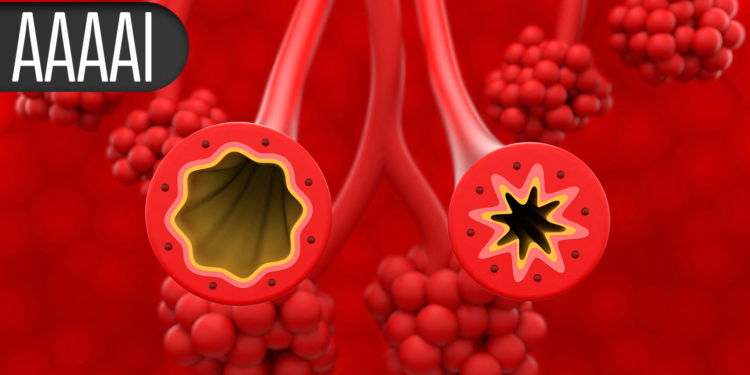 Biologic on Par With OIT for Turning Allergy-Forbidden Foods Into Everyday Eats