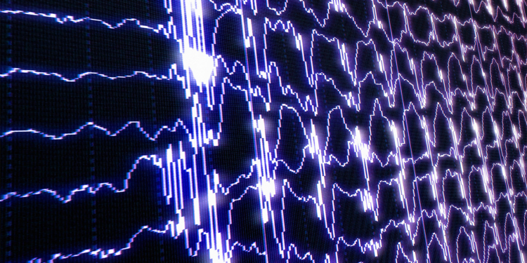 Brain Waves During Sleep Predict Dementia Risk