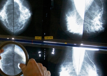 Breast cancer cases in India have more than doubled in three decades, experts say