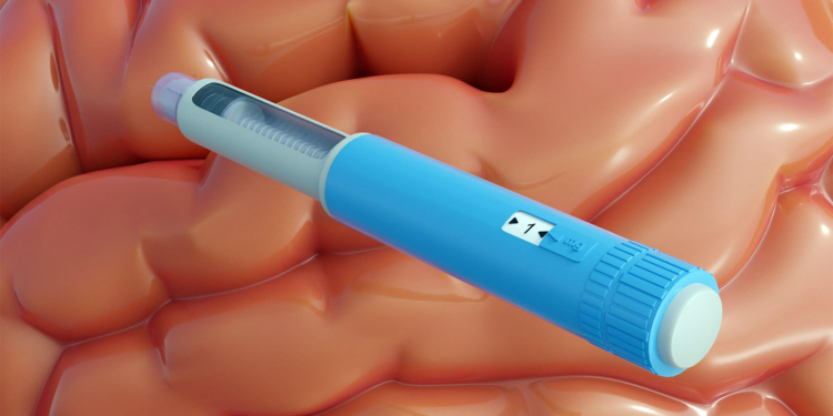 Can GLP-1 Drugs Prevent Worsening Mental Illness? Perhaps, Study Suggests