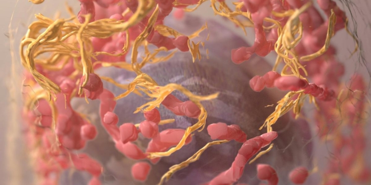 Cholesterol makes cells’ nuclei squishy, helping melanoma spread