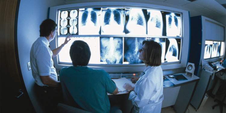 Deepfake X-Rays Sneak Past Radiologists and AI, Underscoring Abuse Potential