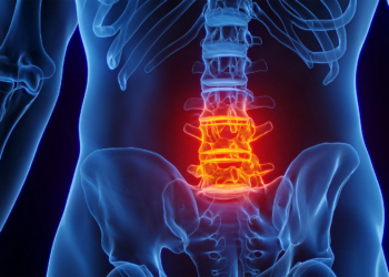 Europe Does Better Than U.S. in Treating Spondyloarthritis, Survey Data Suggest