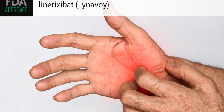 FDA OKs First Drug for Liver Disease-Related Pruritus