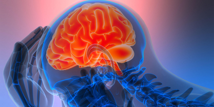 GLP-1 Drugs Tied to Unexpected Migraine Benefits