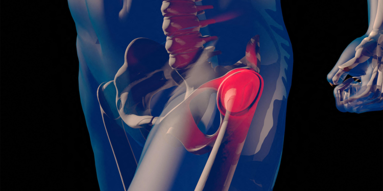 He Didn't Know He Broke 11 Ribs. This Surprise Condition Was to Blame.