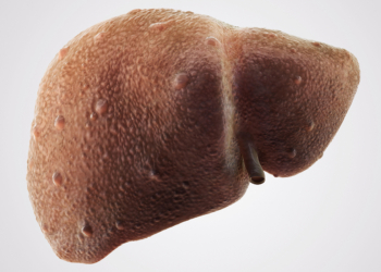 Higher Odds of Liver Fibrosis in Women With Cardiometabolic Risks