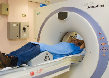 Incidental Findings in Lung Screening Could Indicate Undiagnosed Cancers