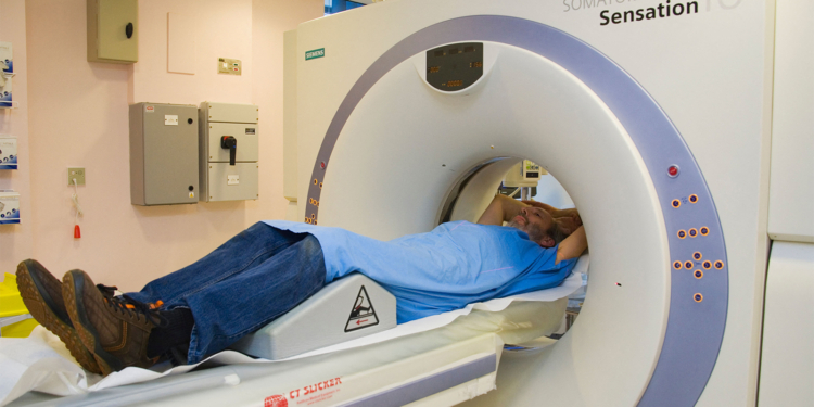 Incidental Findings in Lung Screening Could Indicate Undiagnosed Cancers