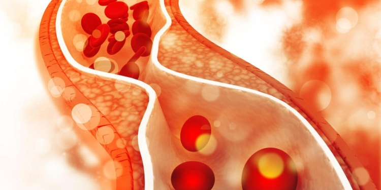 Life-saving numbers: what the 2026 U.S. cholesterol guidelines mean for everyone