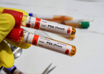 Low Testosterone May Raise Risk of 'Extreme' Prostate Cancer Progression