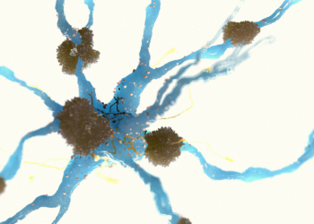 New Study Links Alzheimer's Findings to Old Medical Treatments