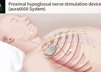 Next-Gen Nerve Stimulator Approved for Obstructive Sleep Apnea
