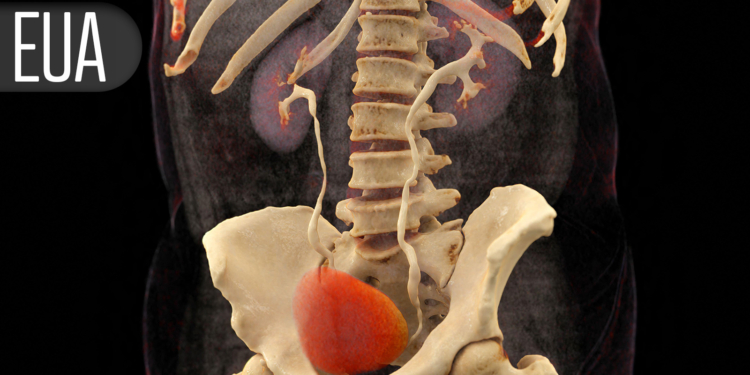 Non-Ablative Treatment for BPH/LUTS Achieves Rapid, Sustained Improvements