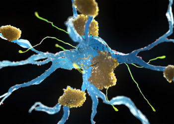 Parkinson's Protein Linked to Faster Alzheimer's Progression in Women