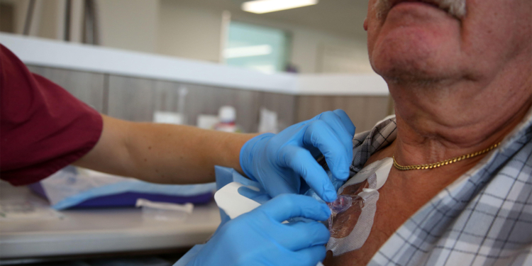 Pre-Op Chemo or Upfront Surgery in Colon Cancer: Is One Strategy Best?