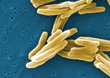 Research identifies new mechanisms to detect and weaken TB bacteria
