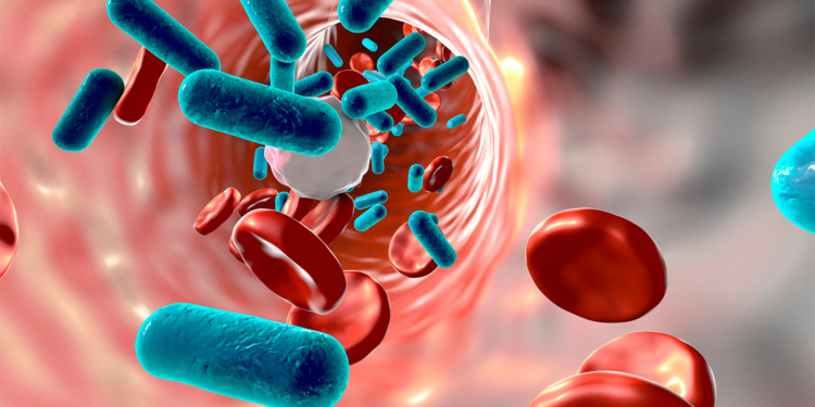 Sepsis Rates Are Up. Here's What Might Explain Why.