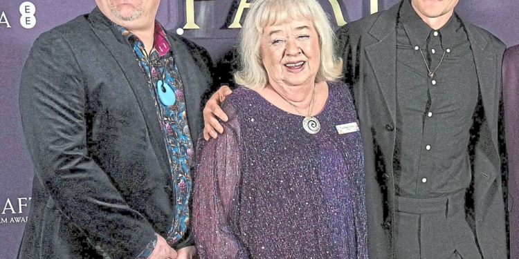 Seven things to know about Tourette Syndrome