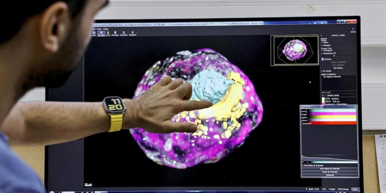 Study finds high consumption of ultra-processed foods linked with reduced fertility in men