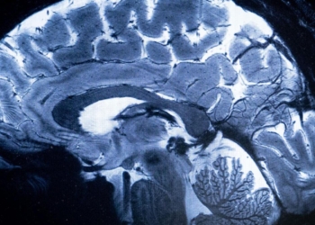 Study finds new biomarker for cognitive symptoms of schizophrenia, could serve as drug target