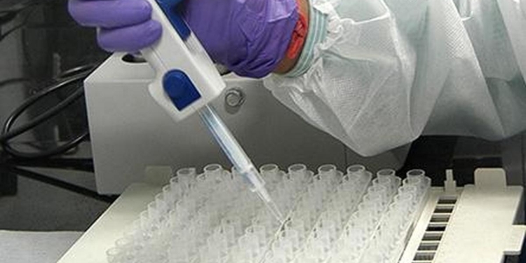 Supreme Court to look into feasibility of NAT for blood transfusion