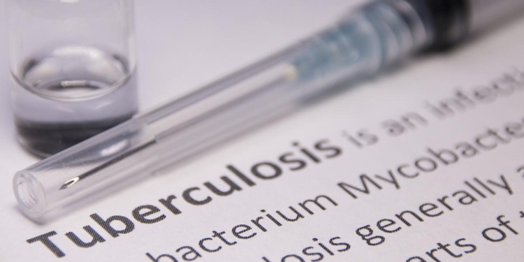 TB survivors seek government clarification on continuity of medicines and diagnostic supplies amid global conflict