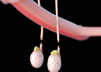 The Vasectomy Conversation: Guideline Reflects Changes in Patients, Talking Points