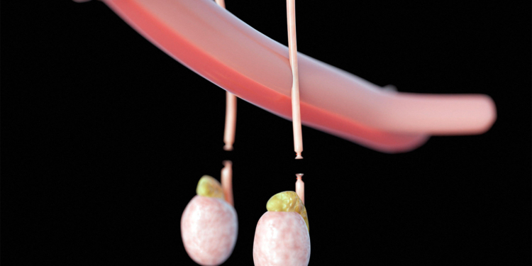 The Vasectomy Conversation: Guideline Reflects Changes in Patients, Talking Points