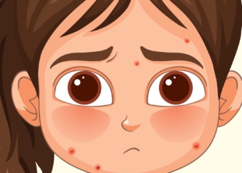 Why do we get chickenpox only once?