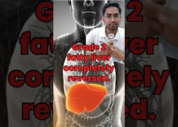 Fatty Liver? Reverse It With These 4 Simple Habits | Dr. Parth #doctor