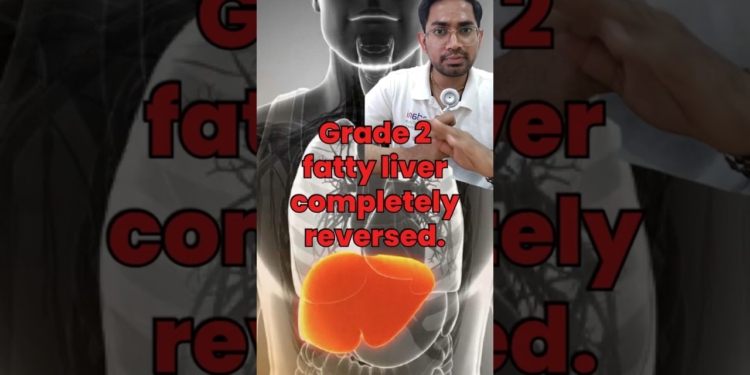 Fatty Liver? Reverse It With These 4 Simple Habits | Dr. Parth #doctor