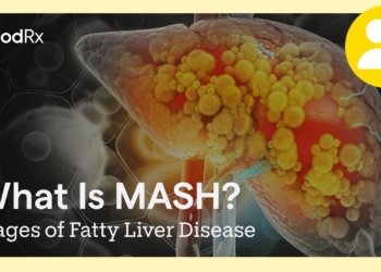 What Is MASH and MASLD? | Stages of Fatty Liver Disease | GoodRx
