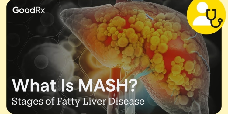 What Is MASH and MASLD? | Stages of Fatty Liver Disease | GoodRx