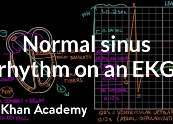 Normal sinus rhythm on an EKG | Circulatory System and Disease | NCLEX-RN | Khan Academy