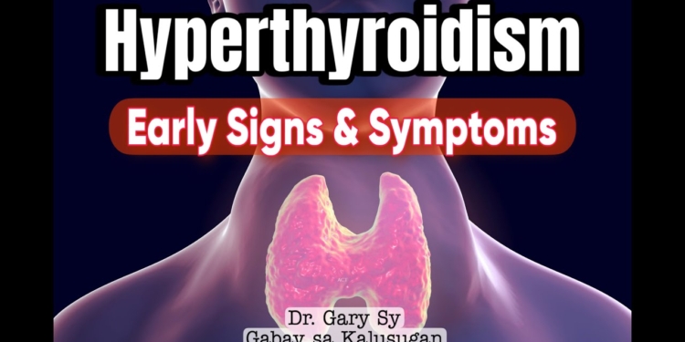 Hyperthyroidism (Overactive Thyroid) - Dr. Gary Sy