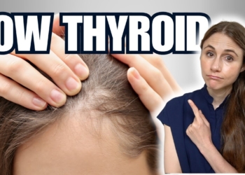 Why Your Thyroid Is Making Your Hair Fall Out